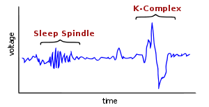 Sample Waveforms